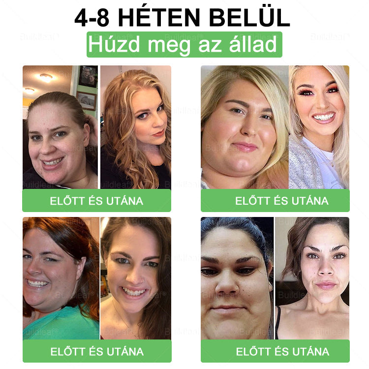 đ MĂĄr csak 5 doboz maradt! Most tovĂĄbbi 50% kedvezmĂ©nyt adunk! LegyĂ©l fitt Ă©s egĂ©szsĂ©ges.