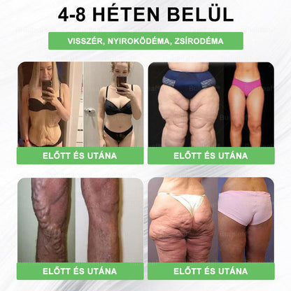 🎁 Már csak 5 doboz maradt! Most további 50% kedvezményt adunk! Legyél fitt és egészséges.